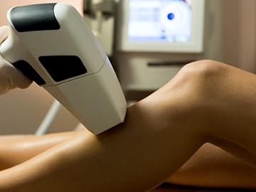 Sezione epilazione laser